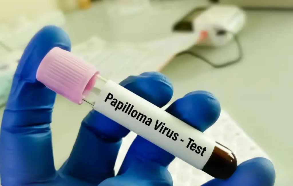 Test papillomavirus femme