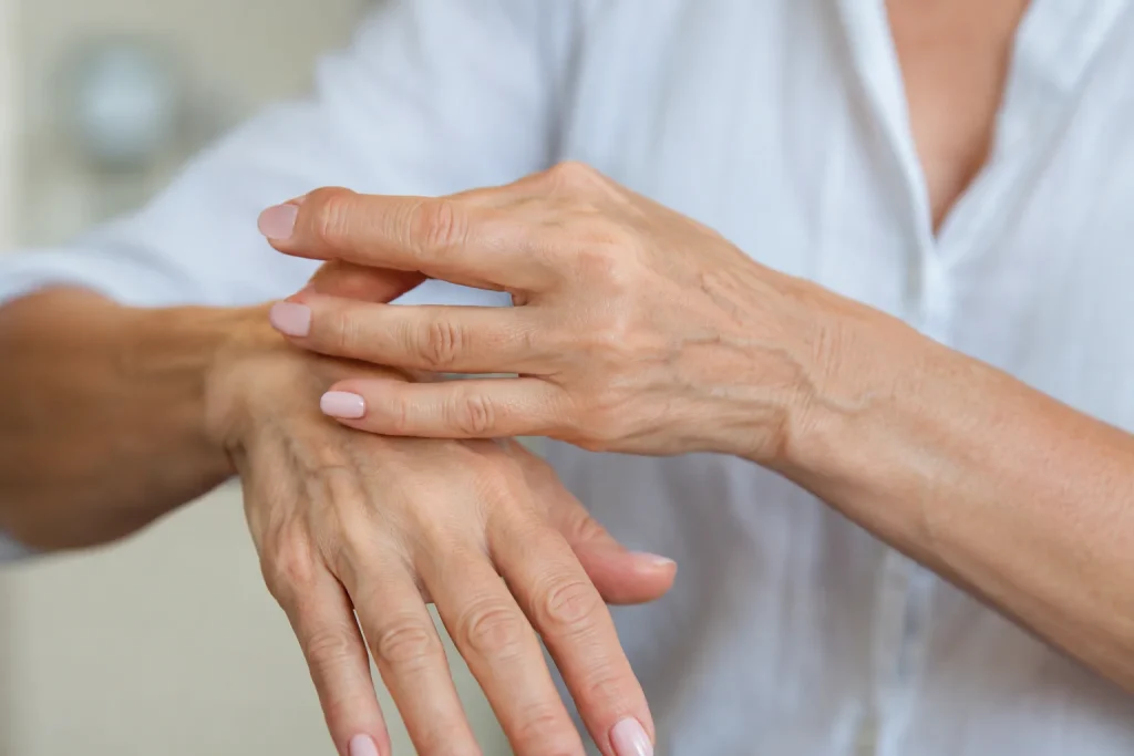 Traiter les veines apparentes sur les mains